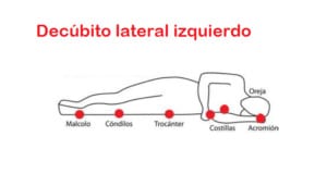 Decúbito lateral izquierdo